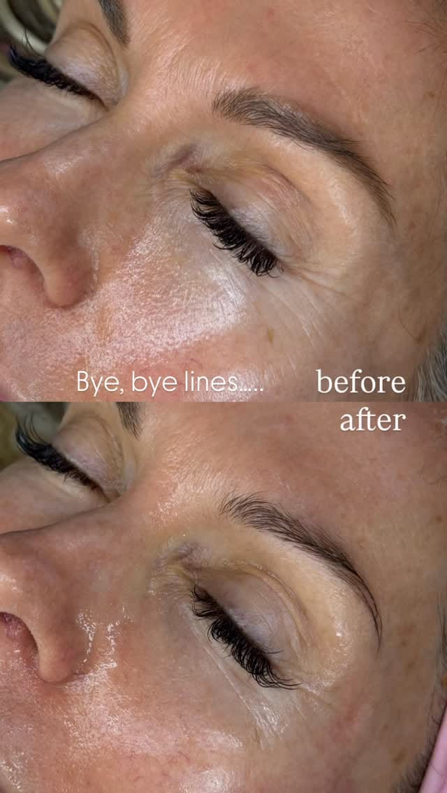 Post 1 by Sugar Esthetics By Nims on Instagram (video)