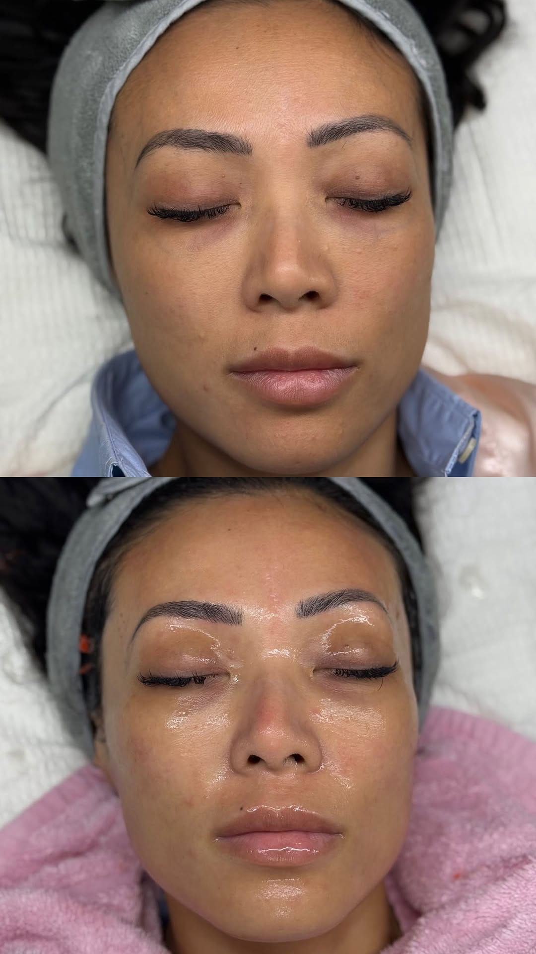 Post 7 by Sugar Esthetics By Nims on Instagram (video)