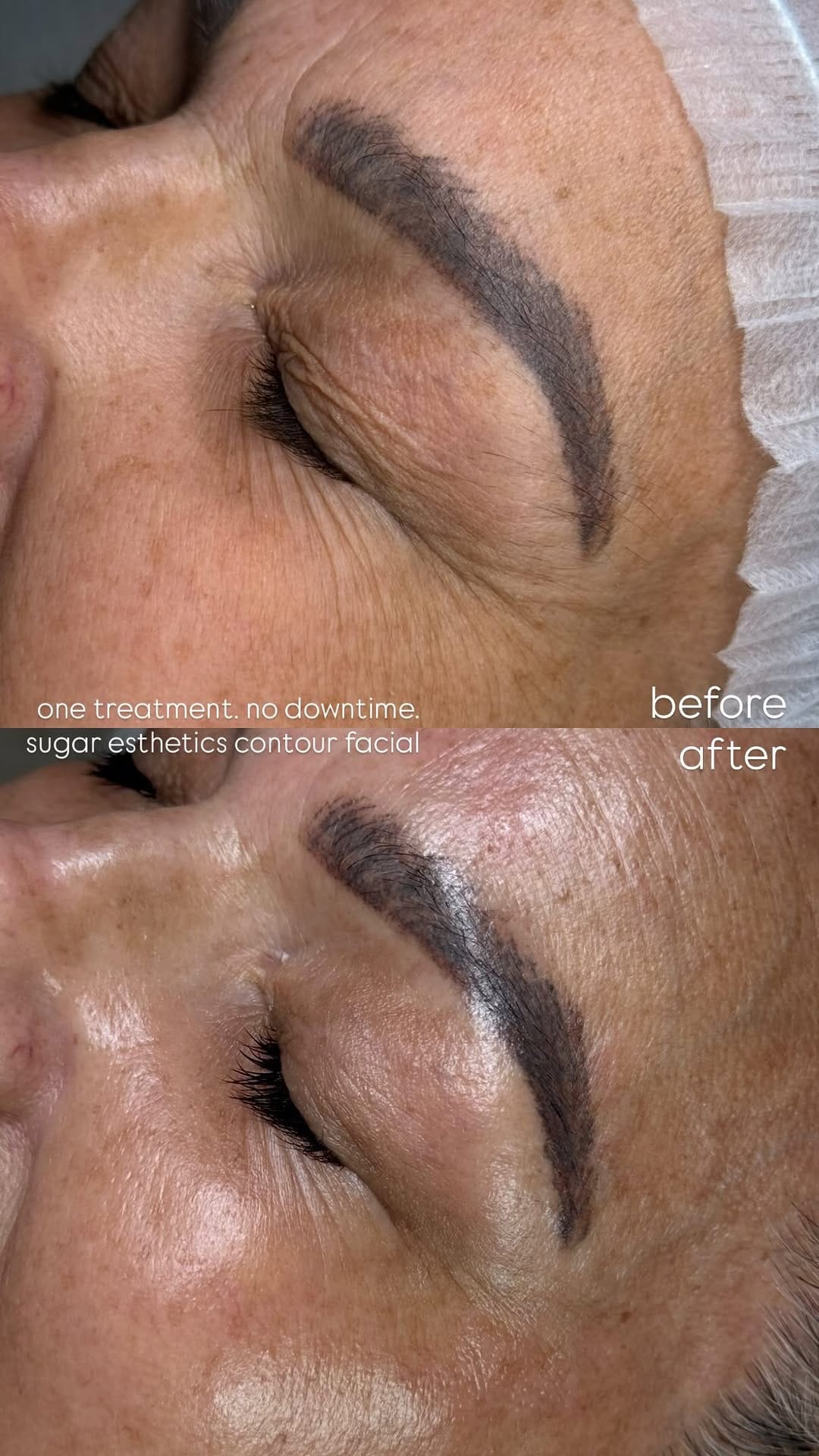 Post 5 by Sugar Esthetics By Nims on Instagram (video)