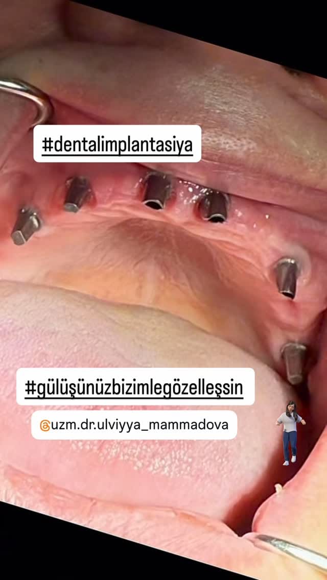 Post 1 by PhD Uzm.Dr.Ulviyya Mammadova on Instagram (video)