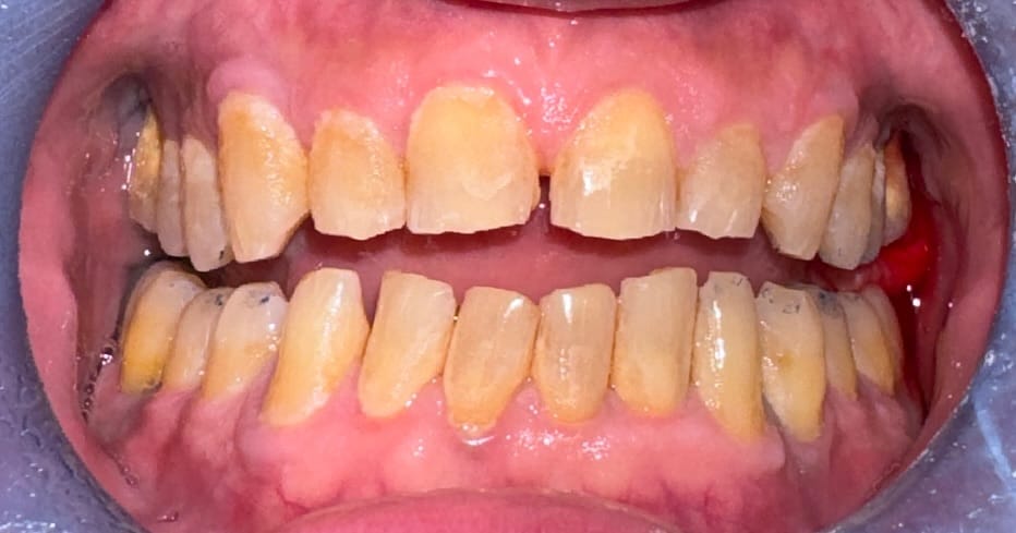 Post 10 by Dr. Ebere Iheanacho DDS on Instagram (carousel)