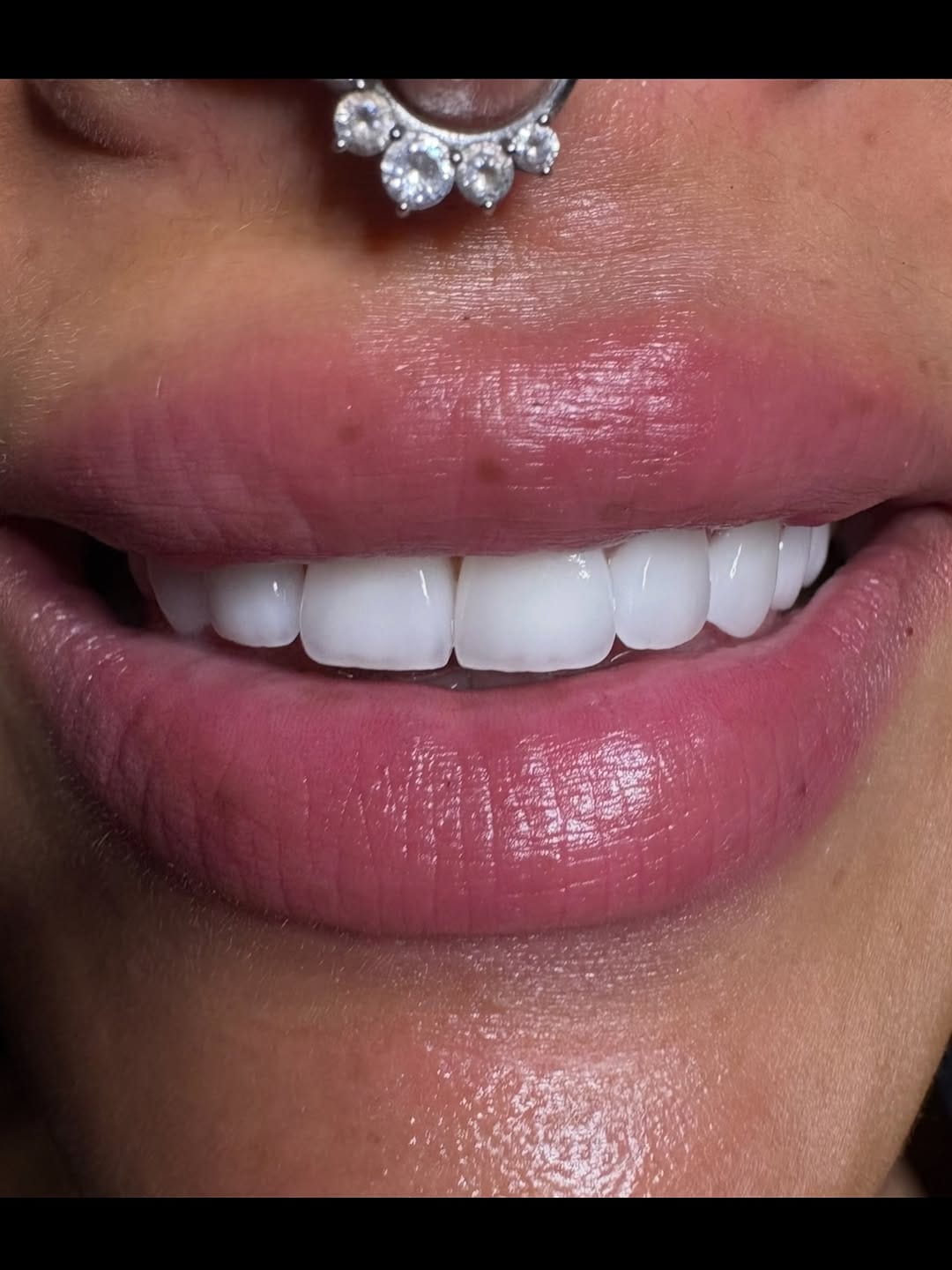 Post 9 by Dr. Ebere Iheanacho DDS on Instagram (carousel)