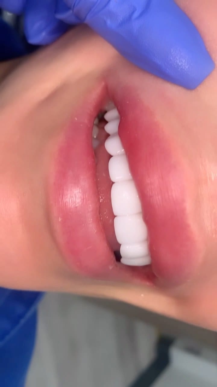 Post 10 by Precise Dental of Houston ®️ on Instagram (video)