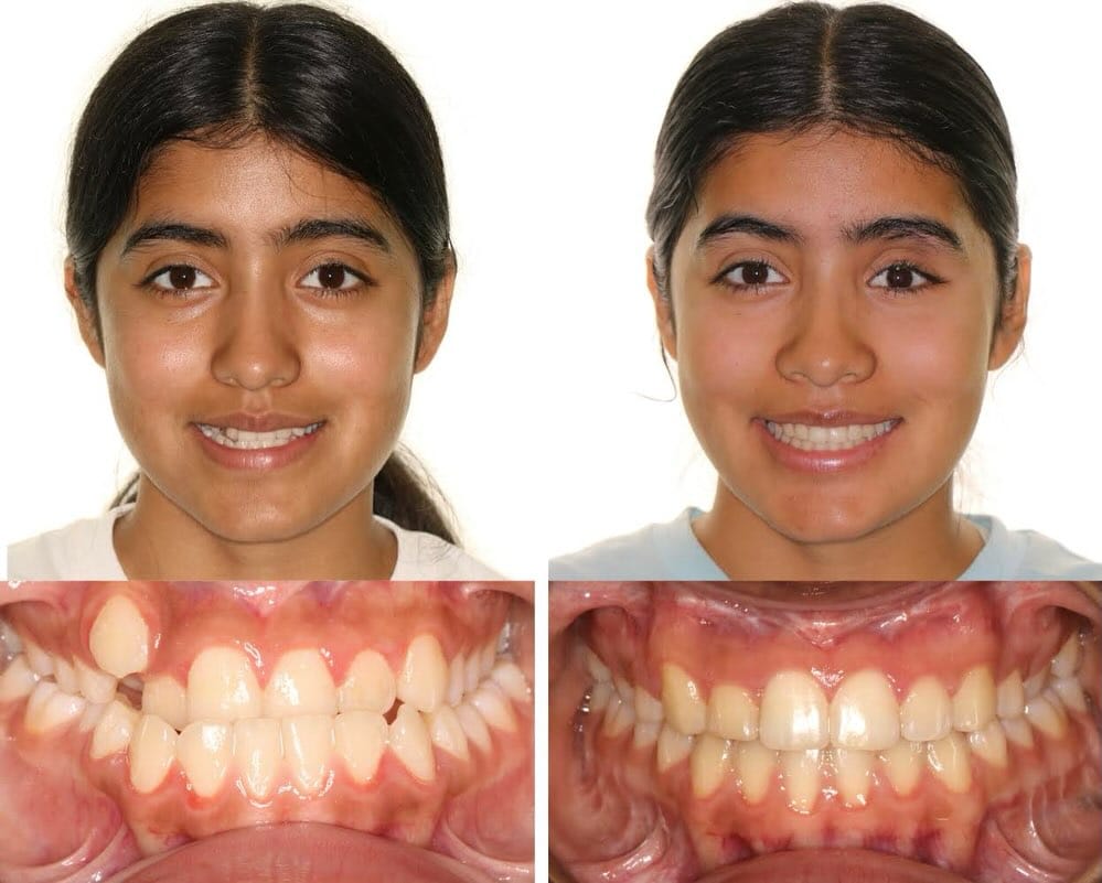Post 5 by Juan-Pablo Porte DDS MSD on Instagram (carousel)