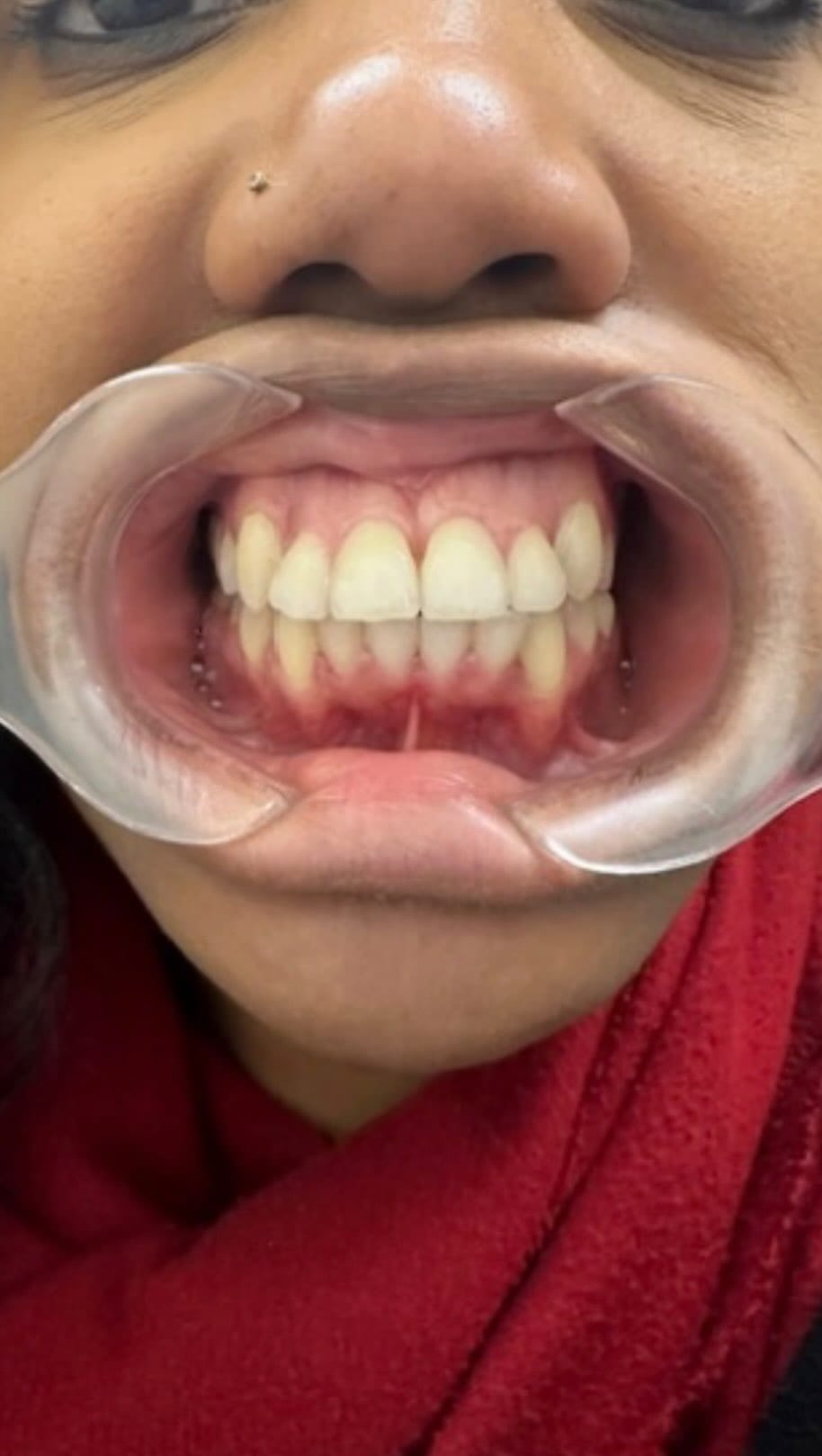 Post 7 by Aces Braces™️ on Instagram (video)