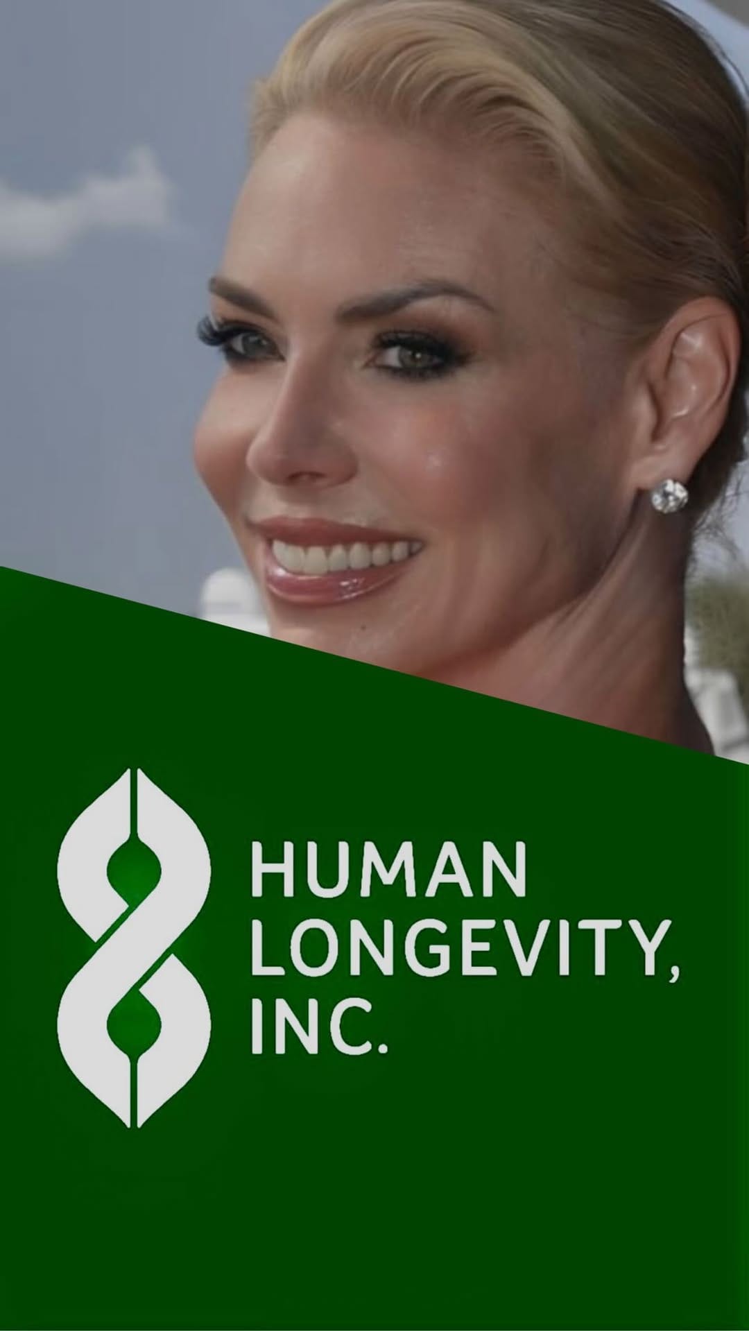 Post 9 by Human Longevity, Inc. on Instagram (video)