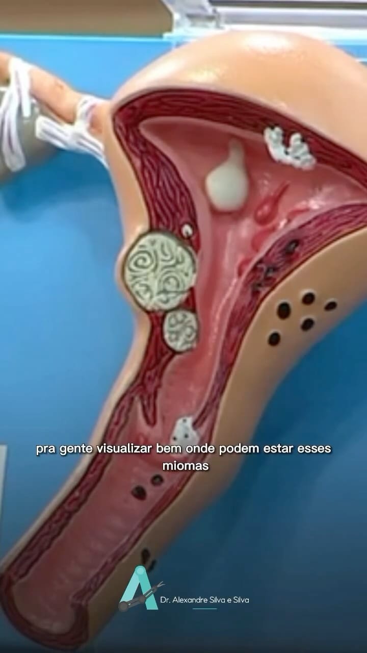 Post 2 by Dr. Alexandre Silva e Silva on Instagram (video)