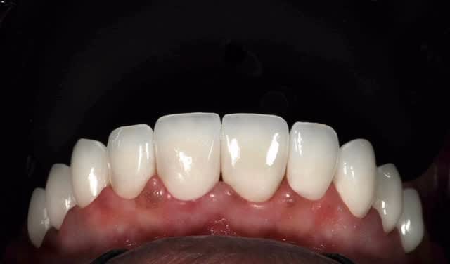 Post 6 by Los Angeles Dentist - Erik Ligans on Instagram (video)
