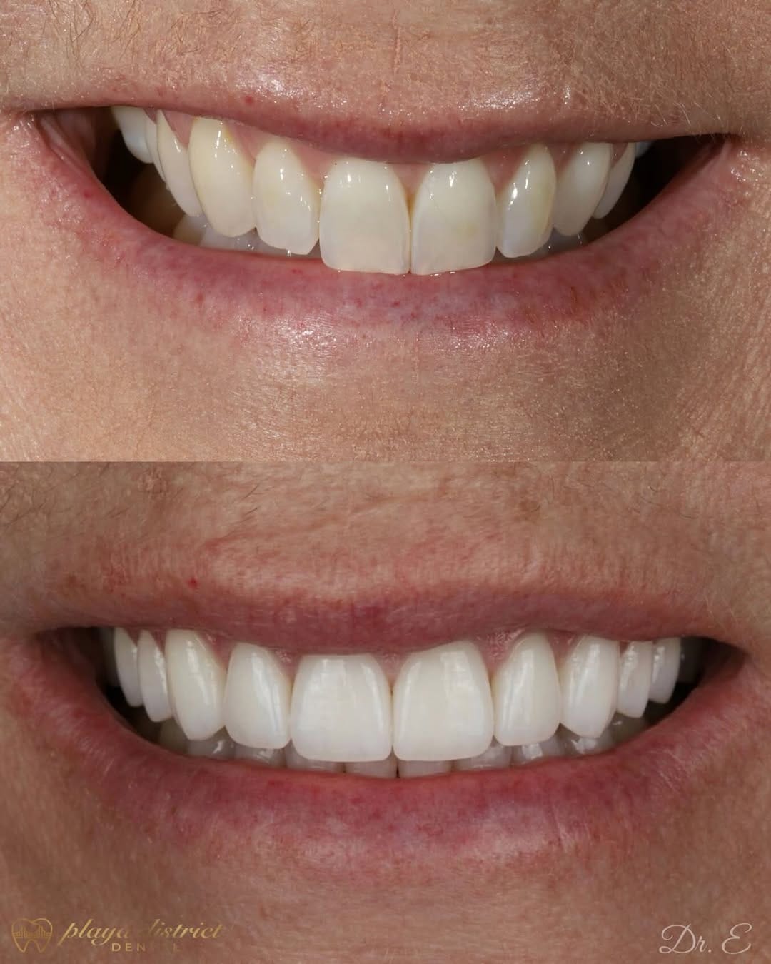 Post 1 by Los Angeles Dentist - Erik Ligans on Instagram (image)