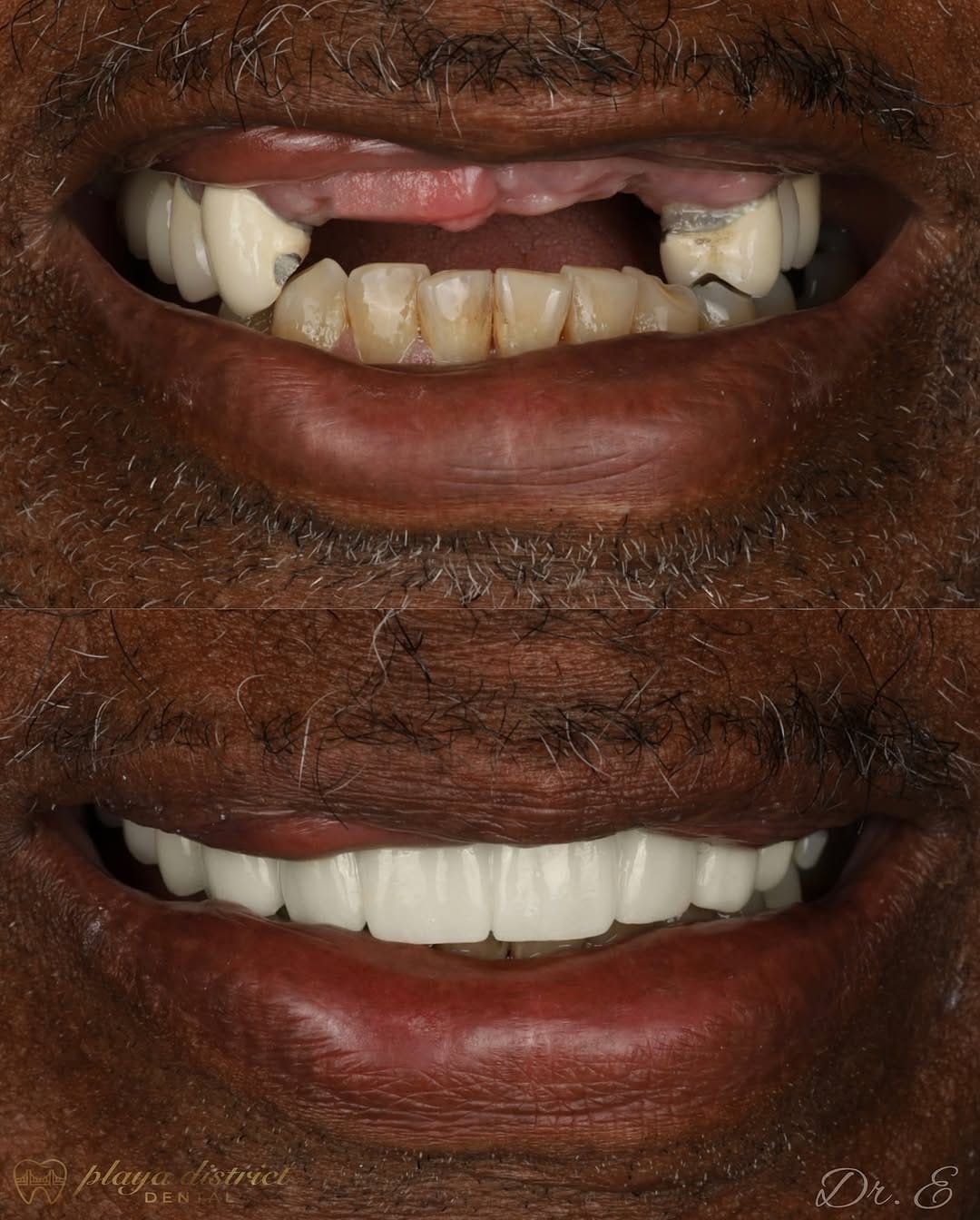 Post 8 by Los Angeles Dentist - Erik Ligans on Instagram (image)