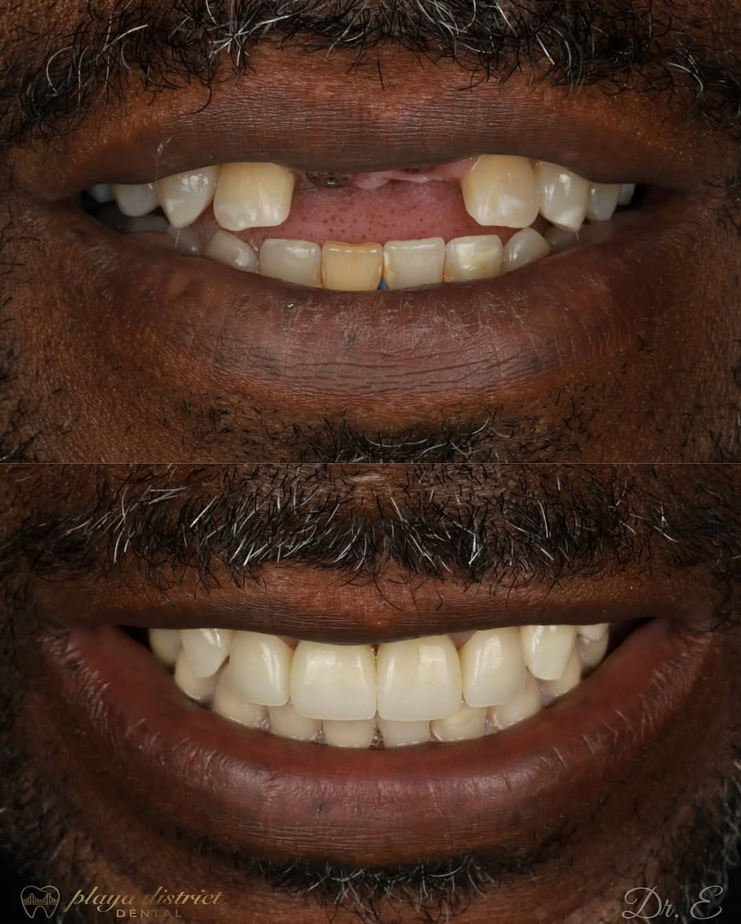 Post 10 by Los Angeles Dentist - Erik Ligans on Instagram (image)