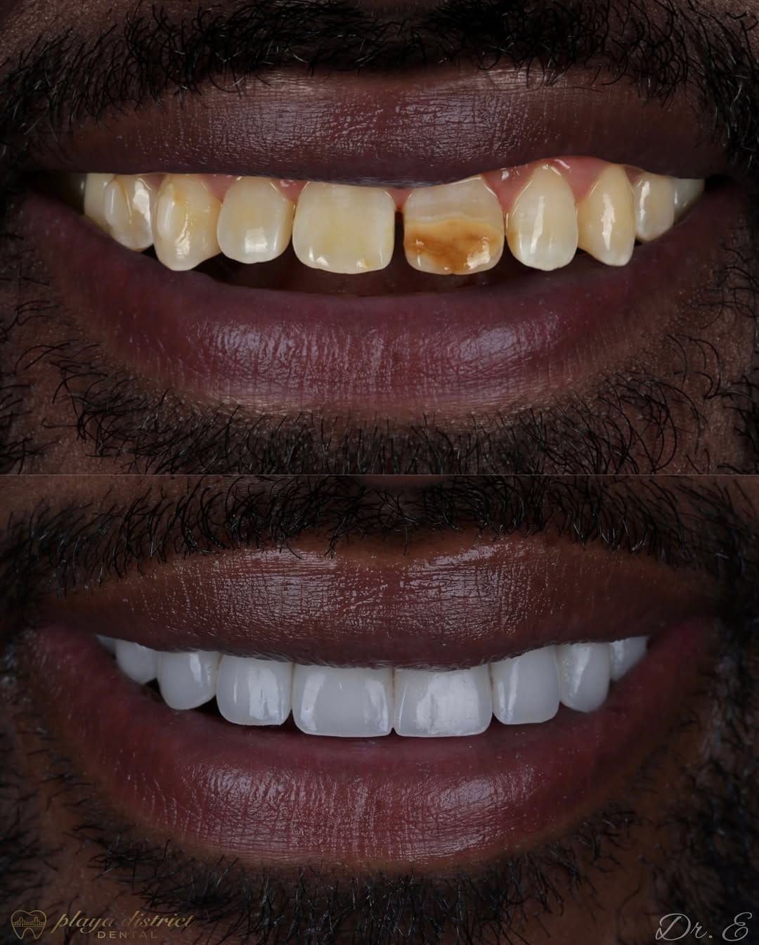 Post 3 by Los Angeles Dentist - Erik Ligans on Instagram (image)
