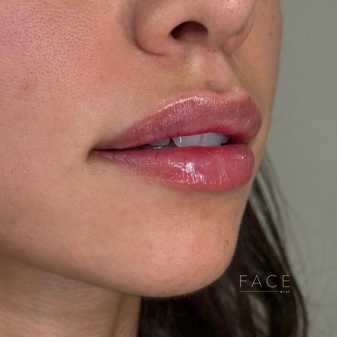 Post 2 by The LAAM | The London Academy of Aesthetic Medicine on Instagram (carousel)