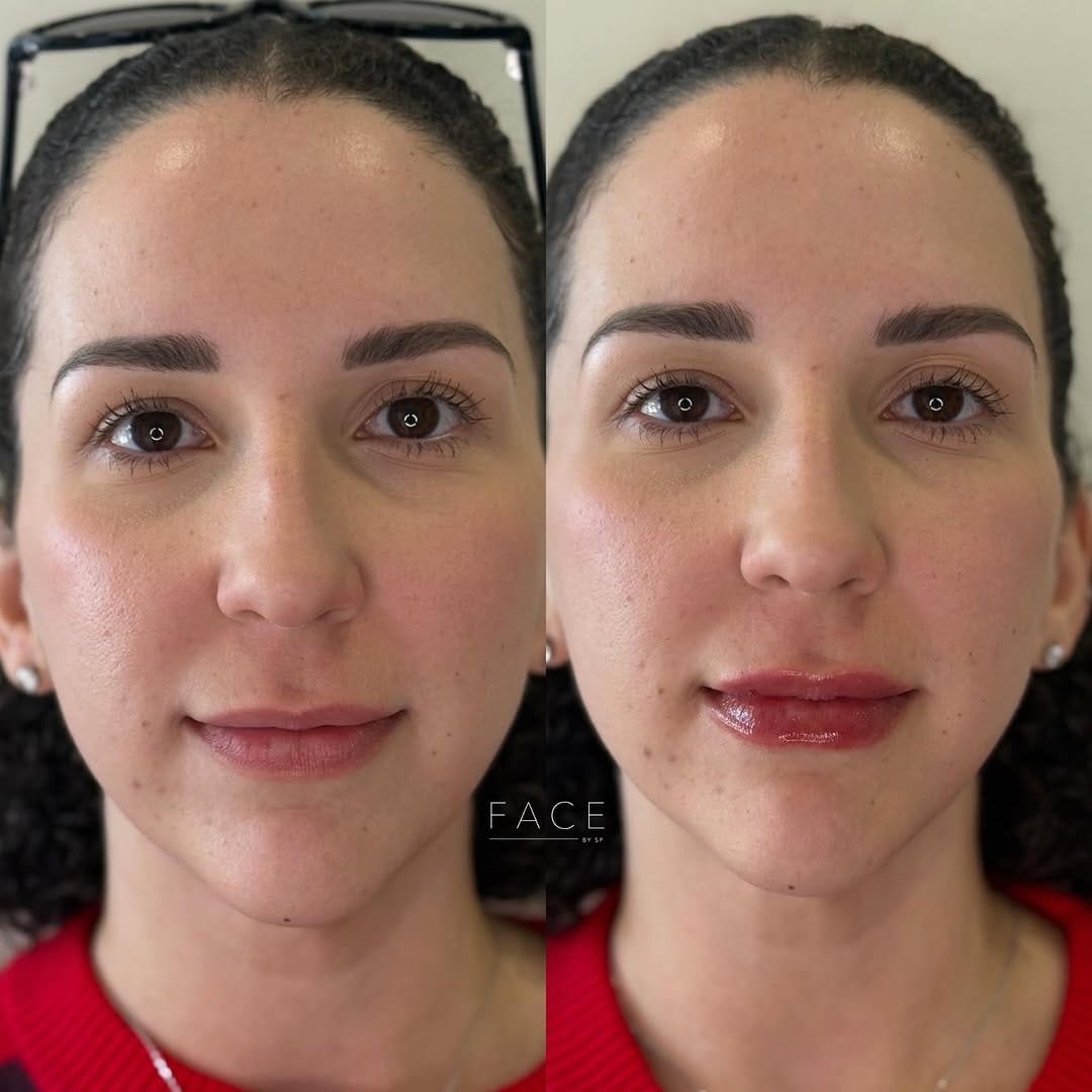 Post 1 by The LAAM | The London Academy of Aesthetic Medicine on Instagram (image)