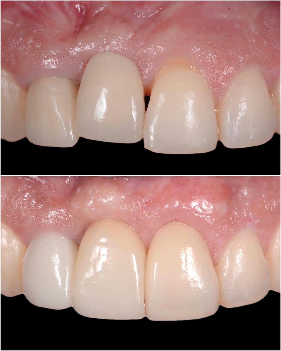 Post 3 by Ismael Khouly DDS, MS, PhD on Instagram (carousel)
