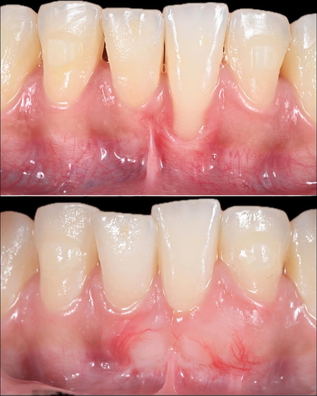 Post 6 by Ismael Khouly DDS, MS, PhD on Instagram (carousel)