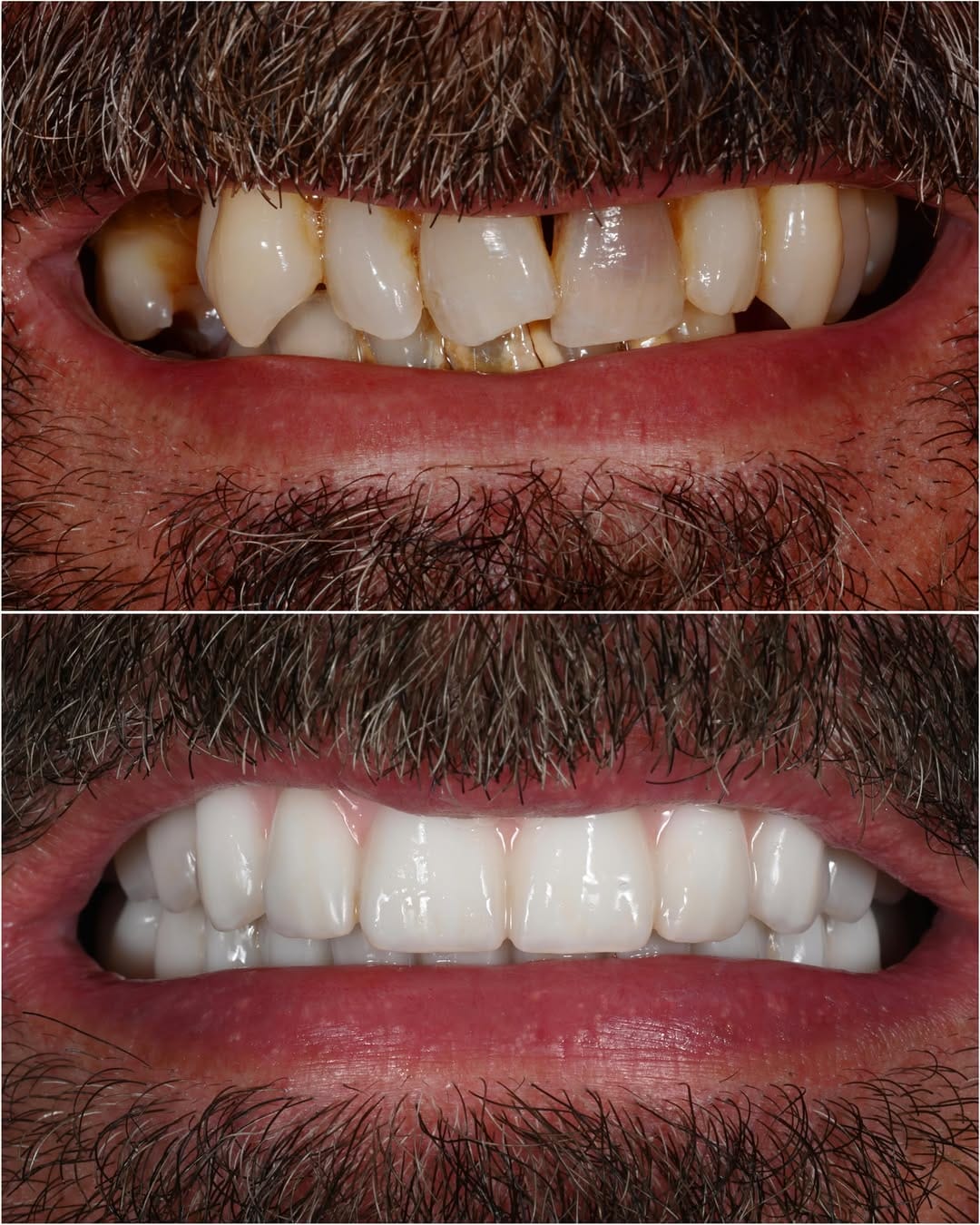 Post 8 by Ismael Khouly DDS, MS, PhD on Instagram (image)