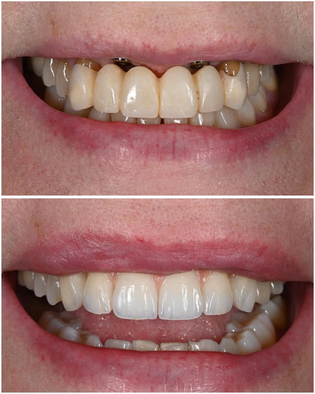 Post 10 by Ismael Khouly DDS, MS, PhD on Instagram (carousel)