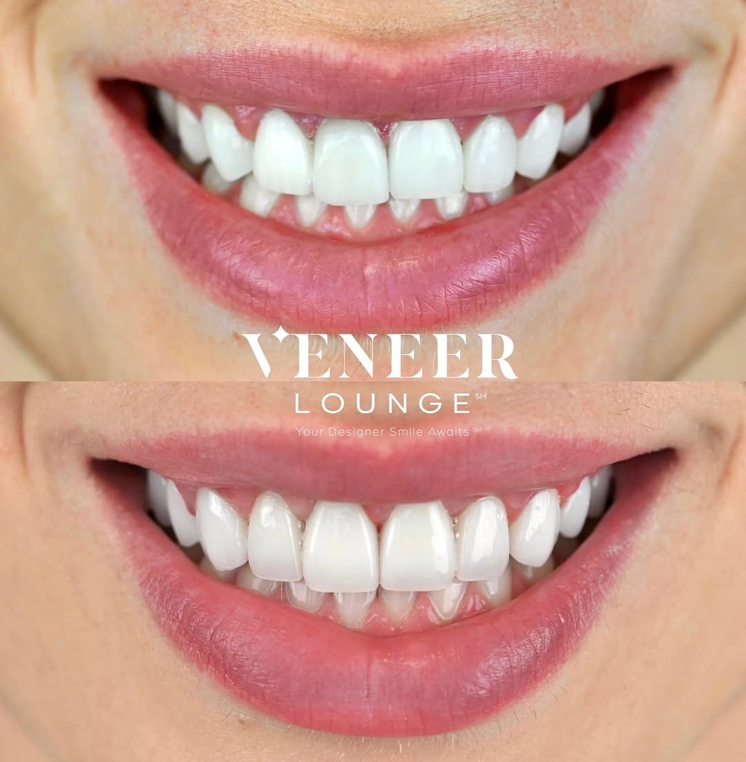 Post 1 by Tania Carvalho, DDS | Cosmetic Dentist in Dallas on Instagram (carousel)