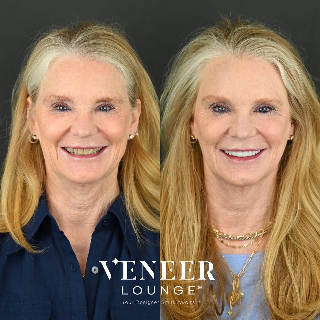 Post 6 by Tania Carvalho, DDS | Cosmetic Dentist in Dallas on Instagram (image)
