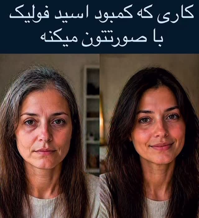 Post 1 by محدثه آقاسي- دکتری تغذیه و رژیم‌درمانی on Instagram (video)