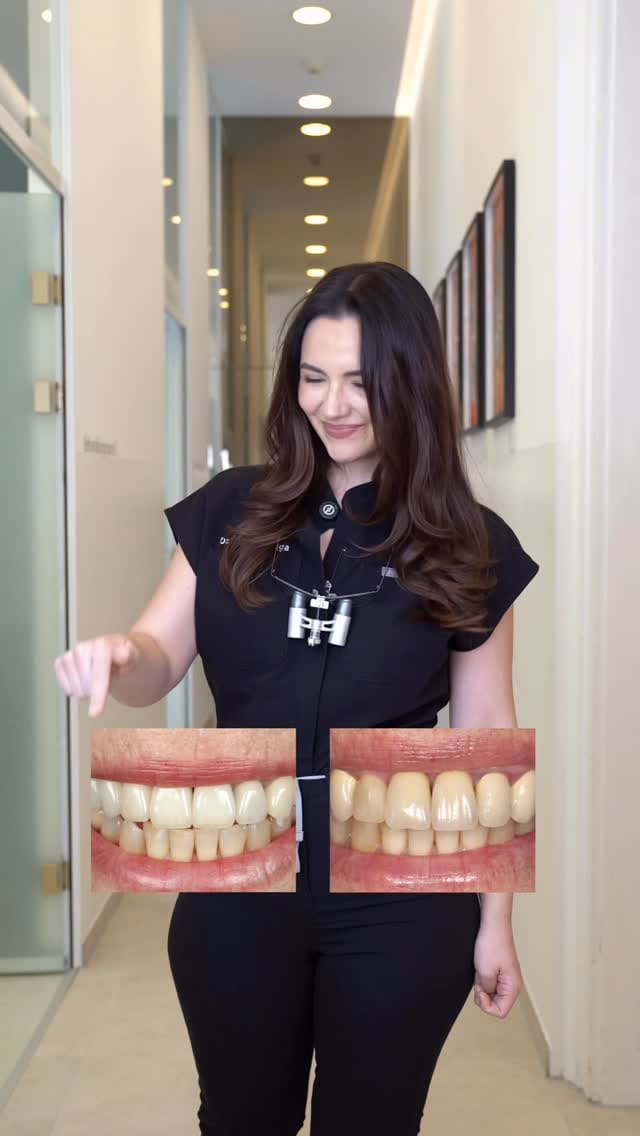 Post 1 by Dr. Andreea Oniga | Zahnärztin on Instagram (video)