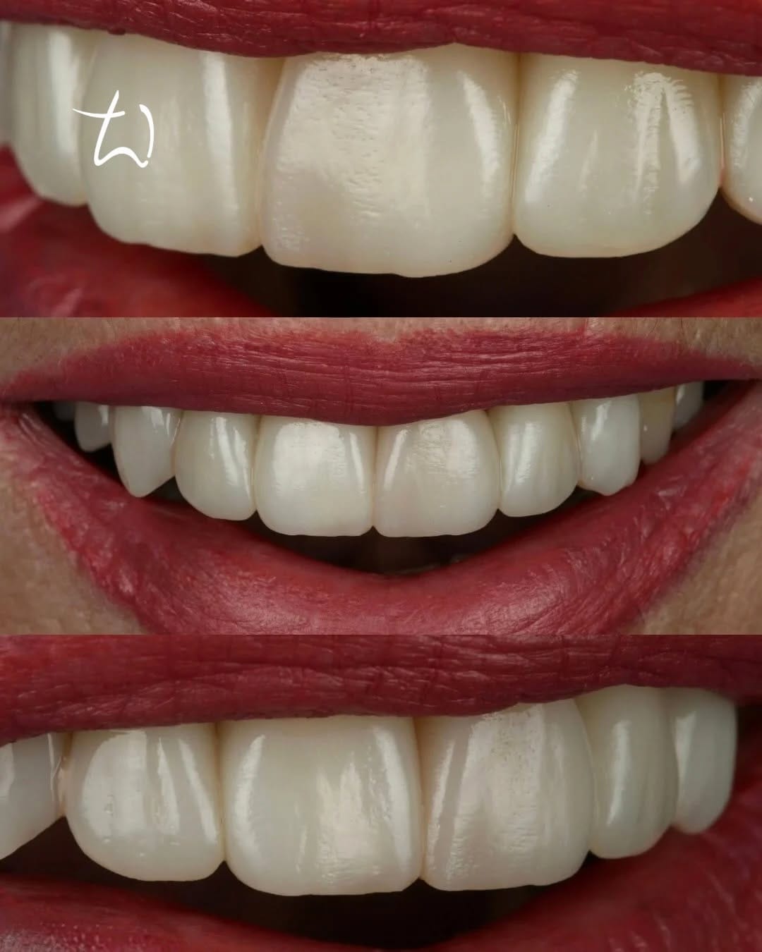 Post 5 by Dr. Andreea Oniga | Zahnärztin on Instagram (carousel)
