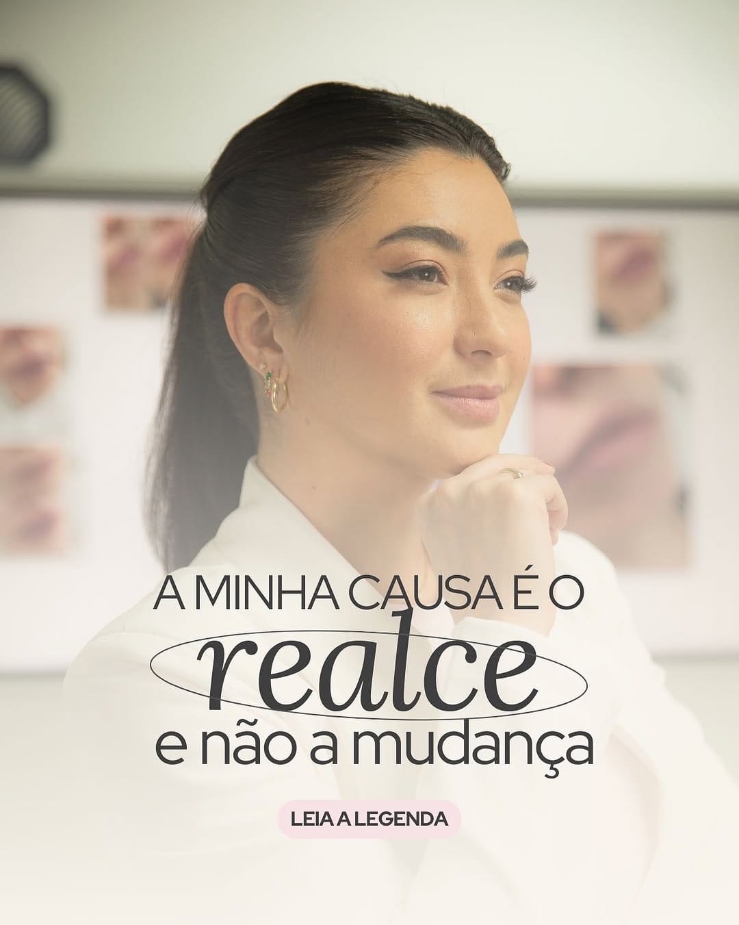 Post 10 by Dra Jana Murai | HARMONIZAÇÃO FACIAL on Instagram (image)