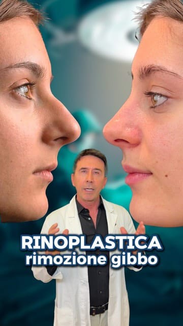 Post 3 by Dr. Massimiliano Quatela - Chirurgo Plastico on Instagram (video)