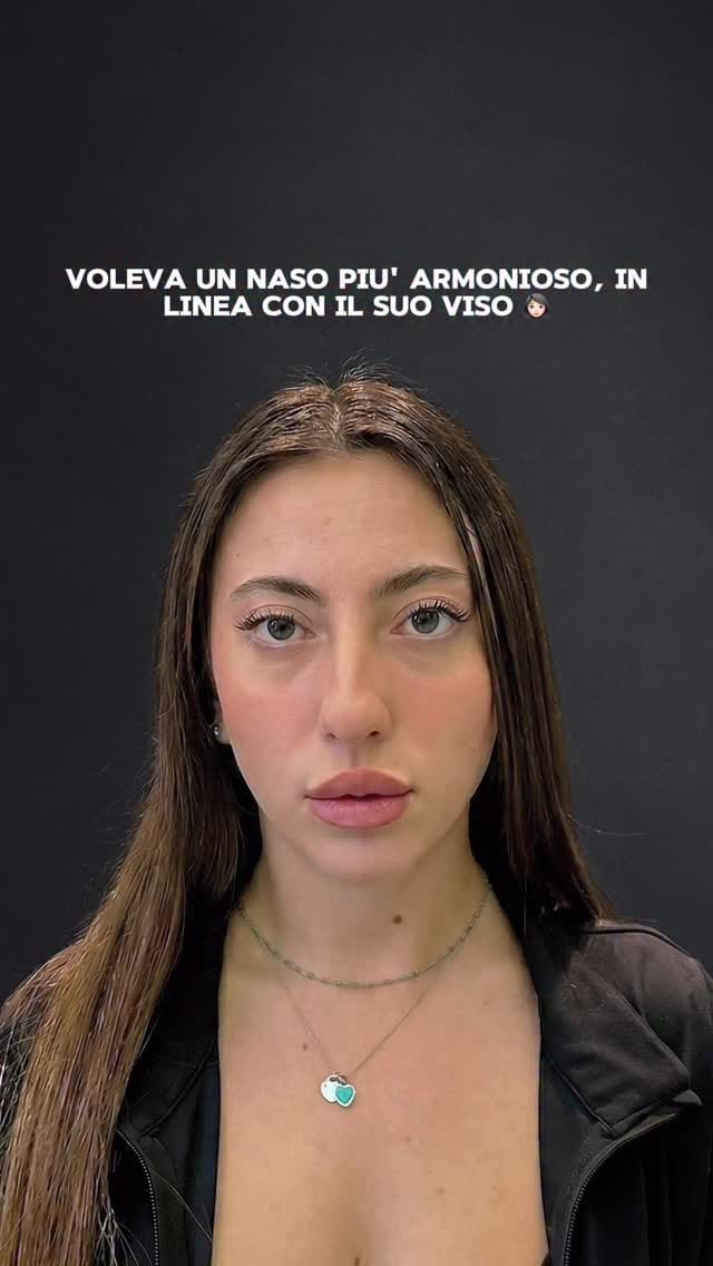 Post 8 by Dr. Massimiliano Quatela - Chirurgo Plastico on Instagram (video)