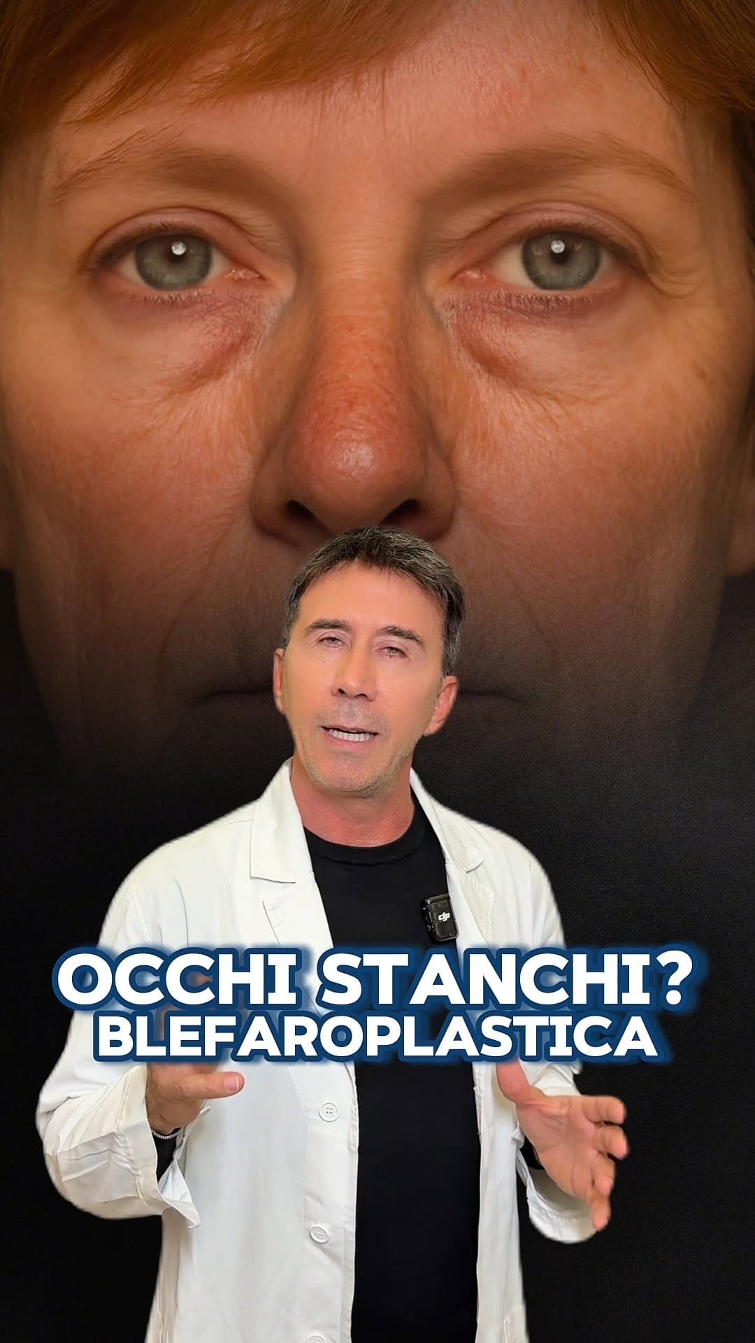 Post 5 by Dr. Massimiliano Quatela - Chirurgo Plastico on Instagram (video)