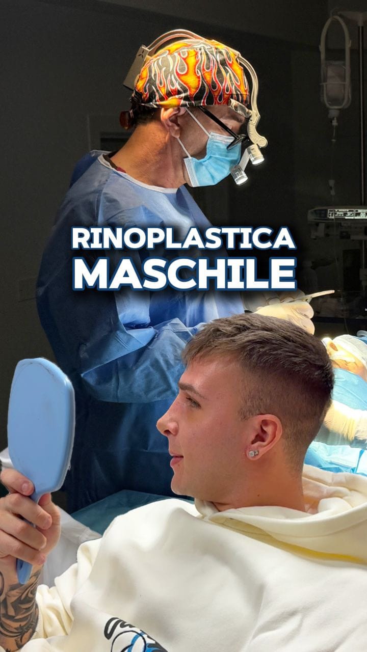 Post 9 by Dr. Massimiliano Quatela - Chirurgo Plastico on Instagram (video)