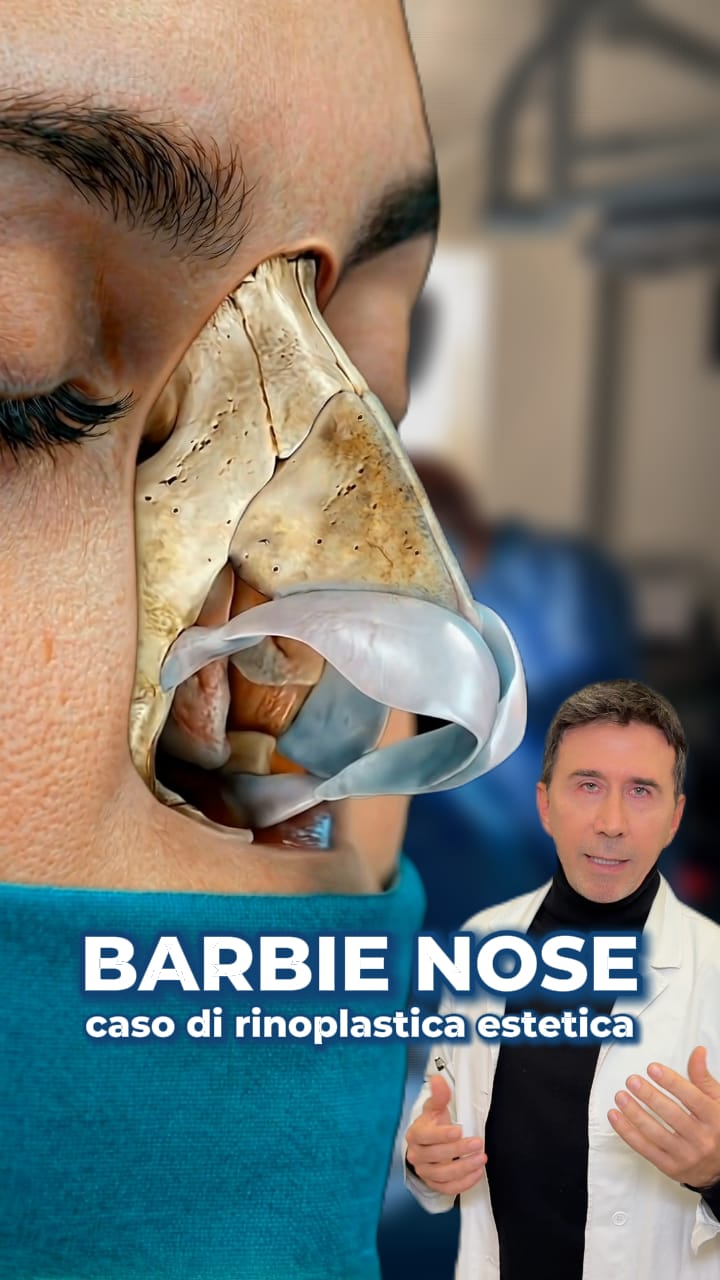 Post 6 by Dr. Massimiliano Quatela - Chirurgo Plastico on Instagram (video)