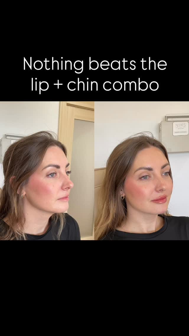 Post 7 by NIKS Medical Spa l Del Mar l San Diego on Instagram (video)