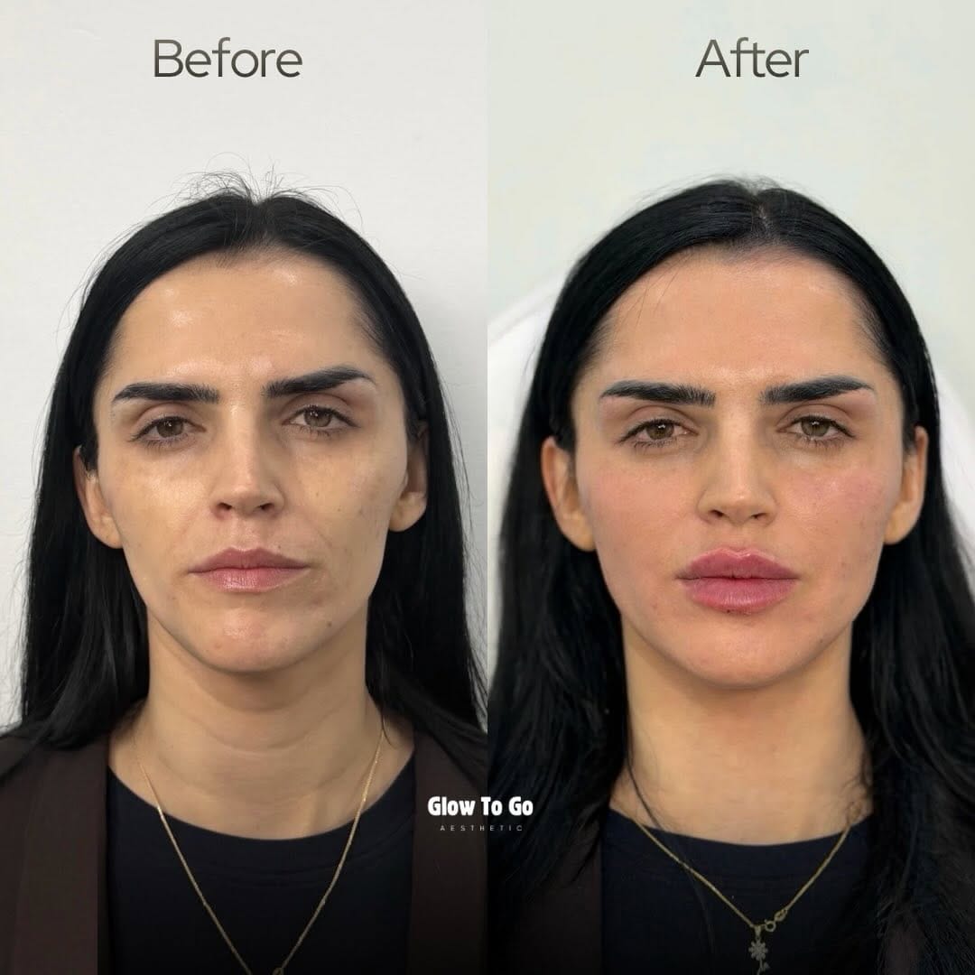 Post 2 by Dr.Ejona Krasniqi on Instagram (image)