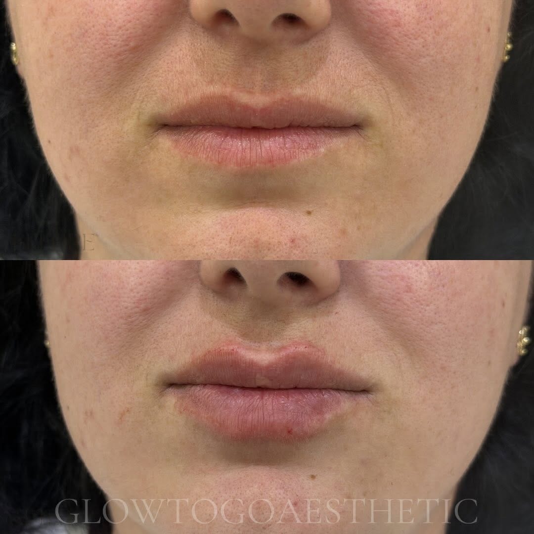 Post 4 by Dr.Ejona Krasniqi on Instagram (image)