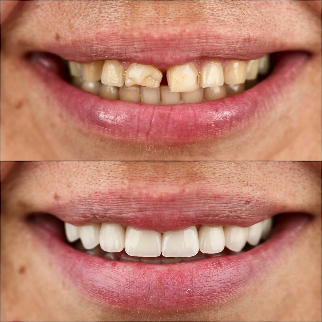 Post 9 by Daniel Adelpour, DDS on Instagram (image)