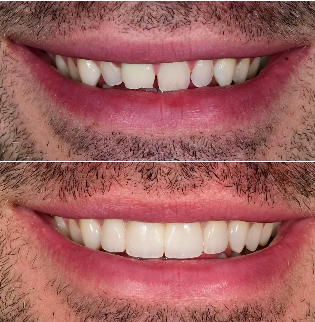Post 8 by Daniel Adelpour, DDS on Instagram (image)
