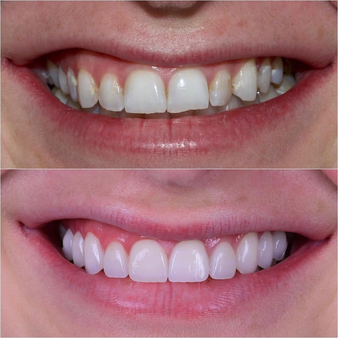 Post 10 by Daniel Adelpour, DDS on Instagram (image)