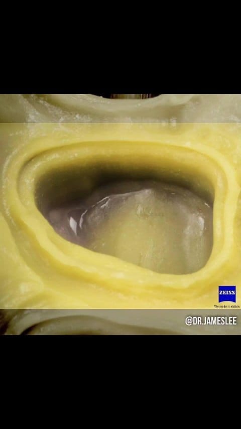 Post 4 by Dr James Lee on Instagram (video)
