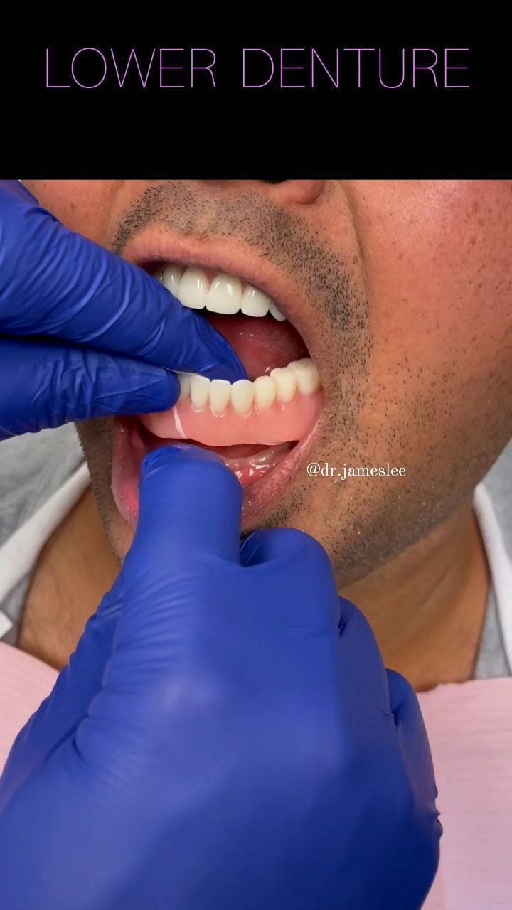 Post 8 by Dr James Lee on Instagram (video)