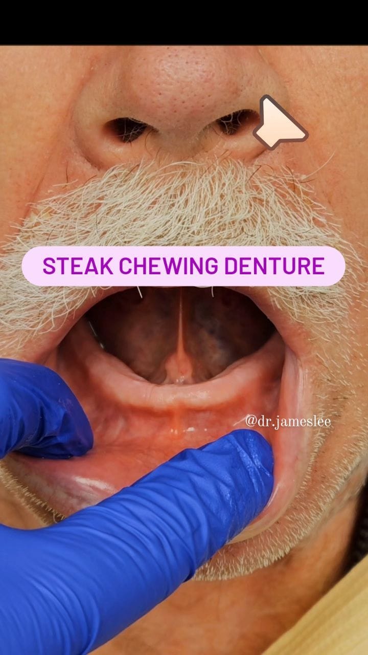 Post 5 by Dr James Lee on Instagram (video)