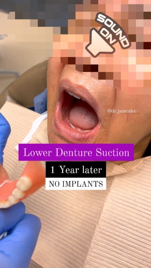 Post 6 by Dr James Lee on Instagram (video)
