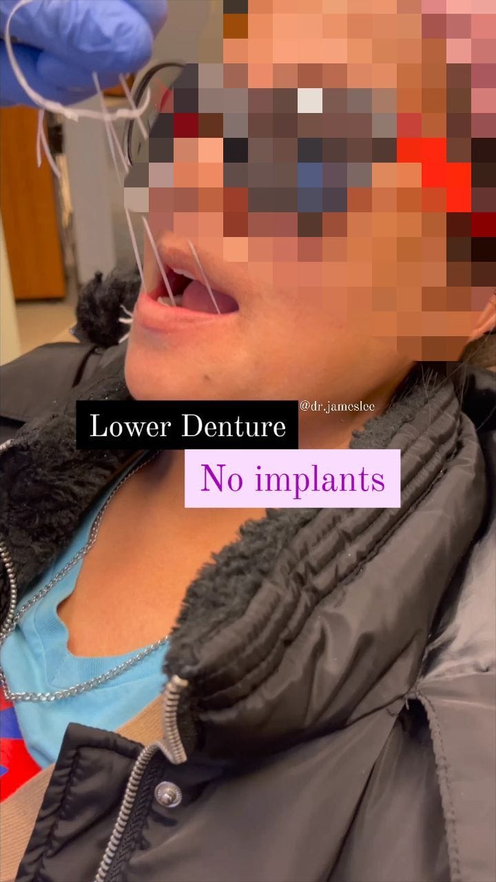 Post 7 by Dr James Lee on Instagram (video)