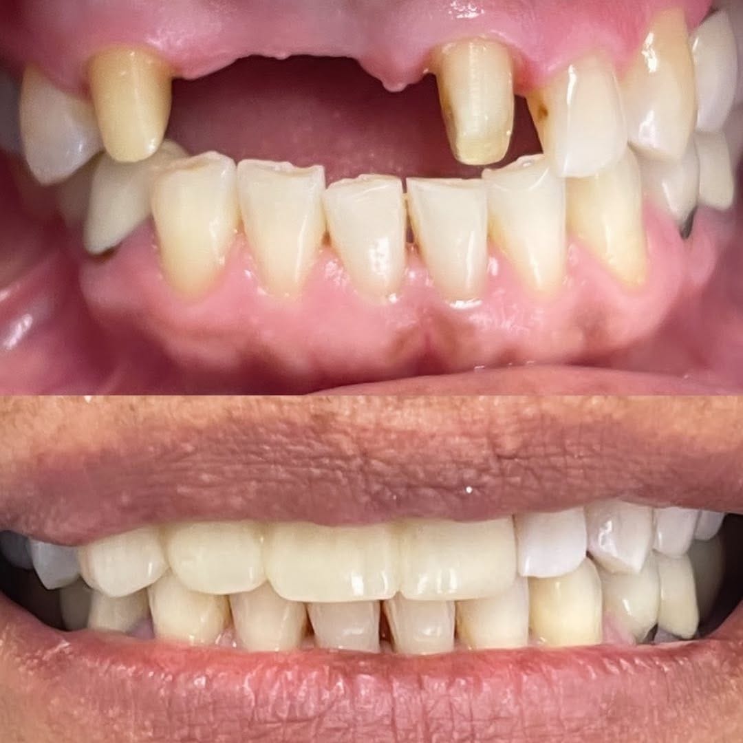 Post 1 by 63 Family Dental®️ on Instagram (image)
