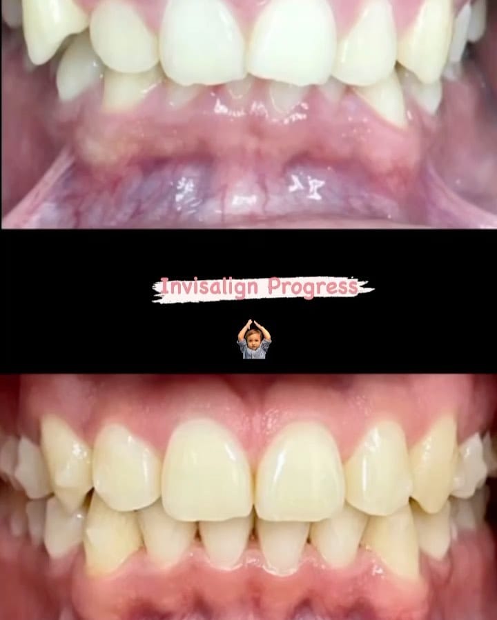 Post 8 by 63 Family Dental®️ on Instagram (video)