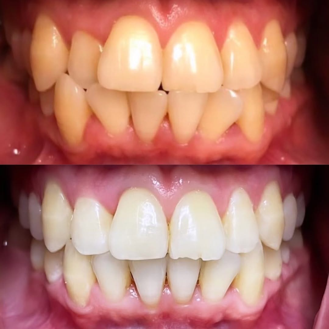 Post 2 by 63 Family Dental®️ on Instagram (image)