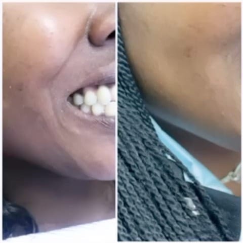 Post 7 by 63 Family Dental®️ on Instagram (video)