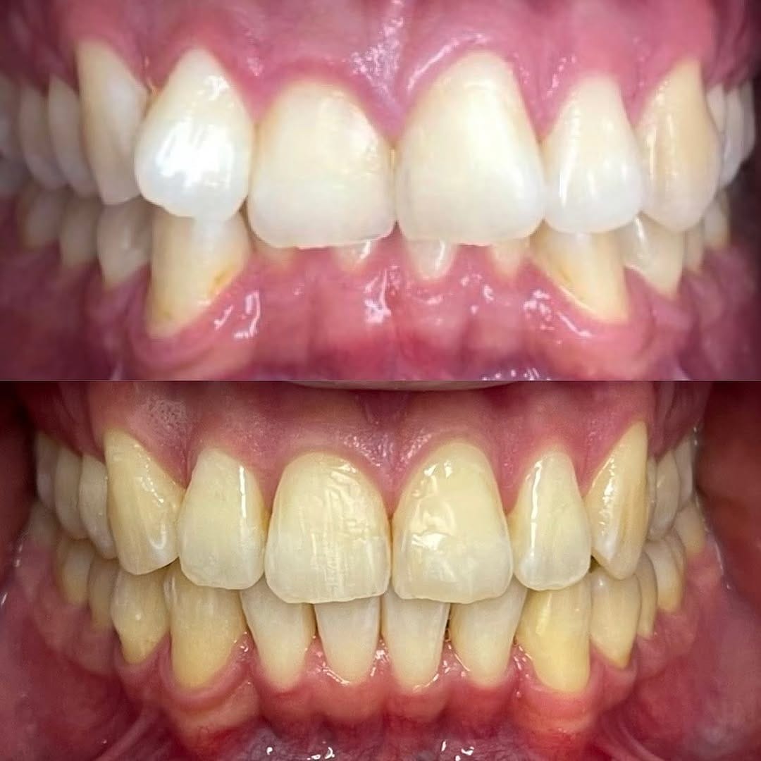 Post 4 by 63 Family Dental®️ on Instagram (carousel)