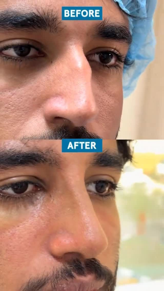 Post 5 by Plastic Surgeon Dubai on Instagram (video)